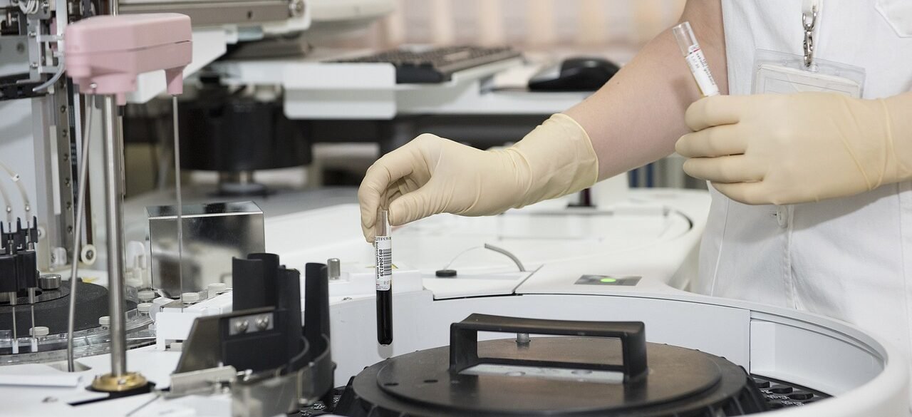 laboratory, test tubes, healthcare worker, hospital, healthcare professional, medical professional, medical technology, medical, health, medicine, healthcare, laboratory, laboratory, laboratory, laboratory, laboratory, hospital, hospital, hospital, hospital, medical, medical, medical, medical, health, health, medicine, medicine, medicine, healthcare, healthcare, healthcare